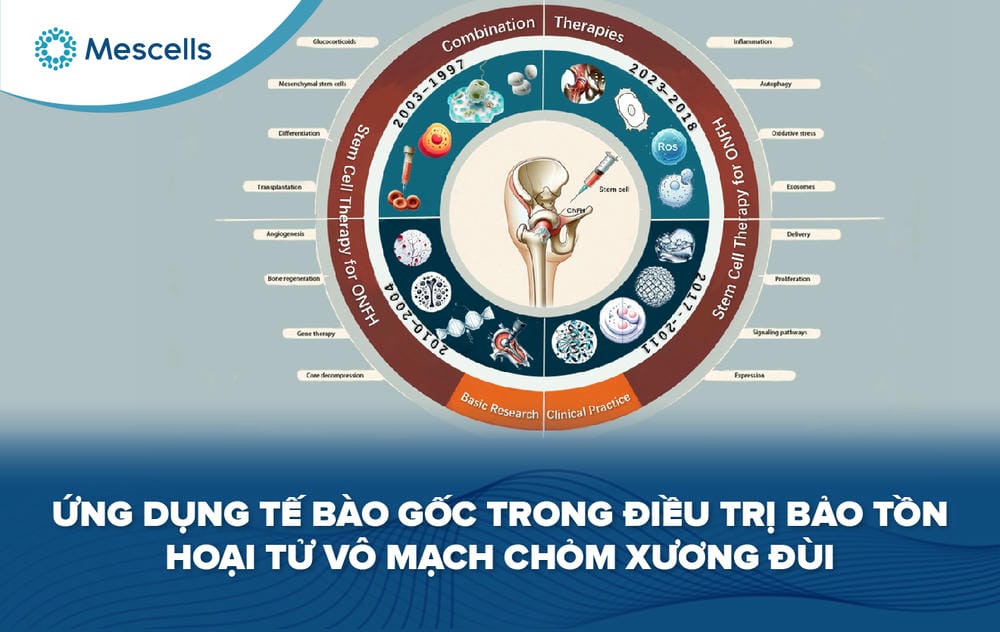 Tế bào gốc trong điều trị hoại tử chỏm xương đùi-01