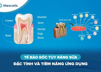 Tế bào gốc tủy răng sữa-01