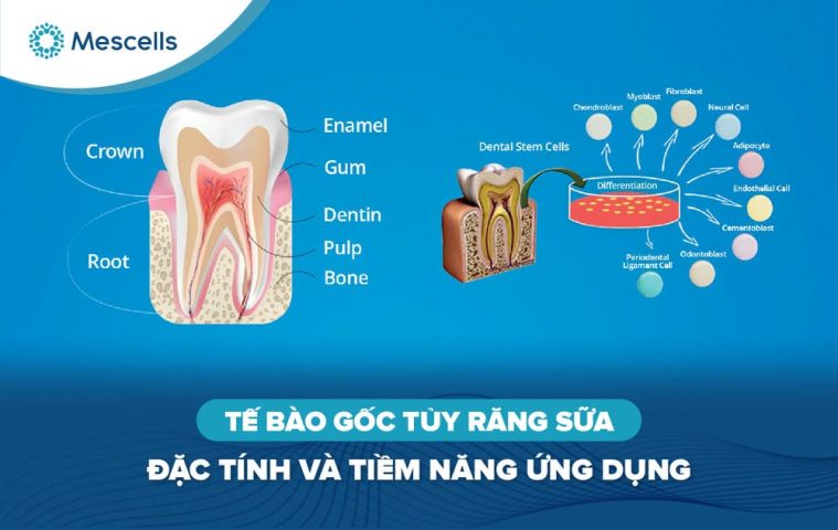 Tế bào gốc tủy răng sữa-01