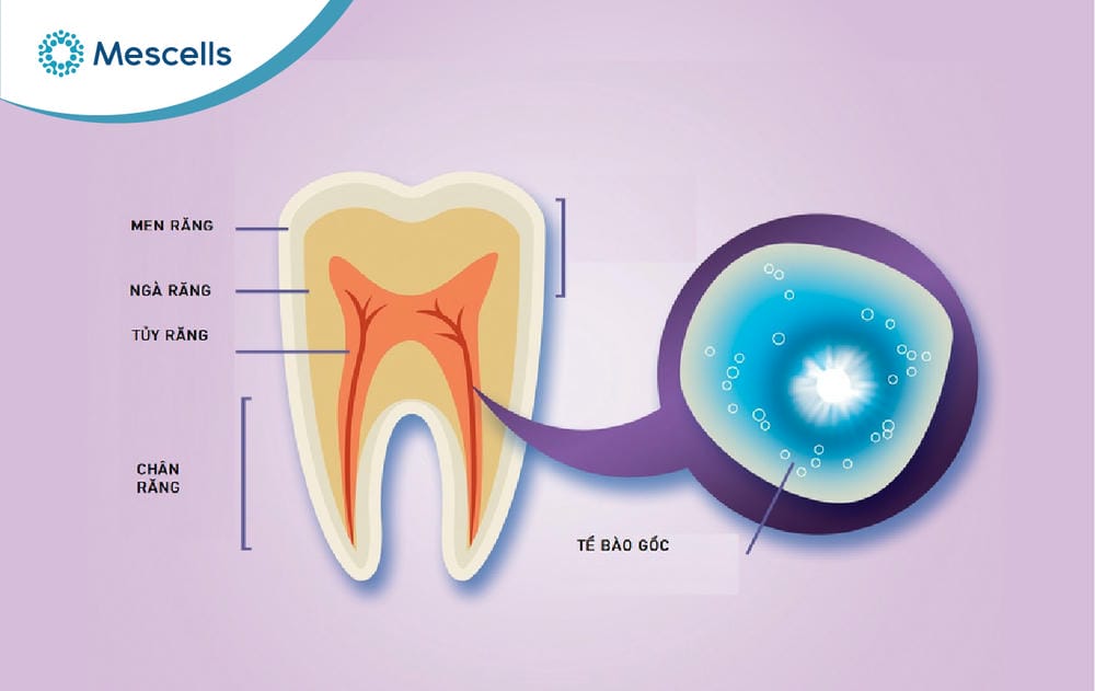 Tế bào gốc tủy răng sữa-02