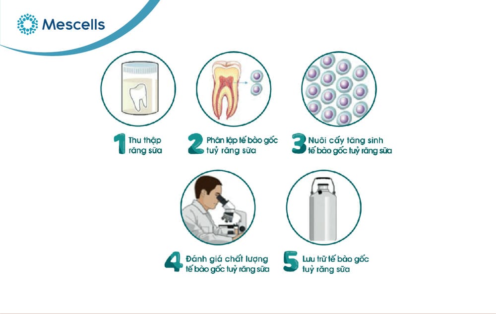 Tế bào gốc tủy răng sữa-05