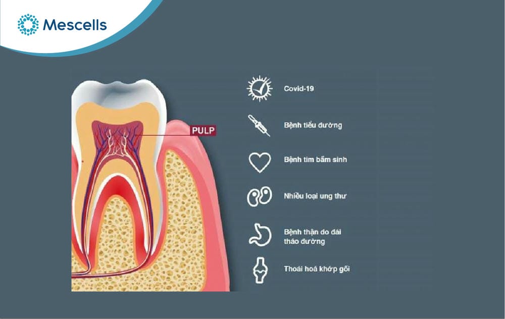 Tế bào gốc tủy răng sữa-06