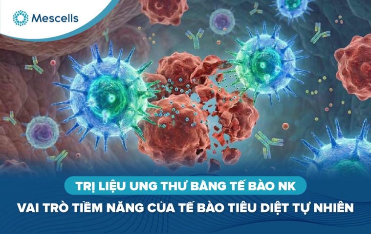 Trị liệu ung thư bằng tế bào NK-01