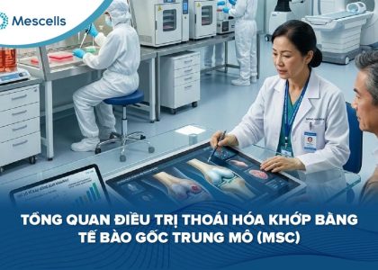 Điều trị thoái hóa khớp bằng tế bào gốc-01