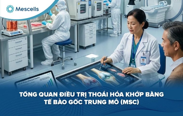 Điều trị thoái hóa khớp bằng tế bào gốc-01