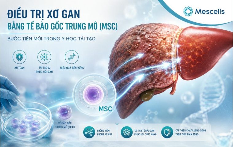 Điều trị xơ gan bằng tế bào gốc-01
