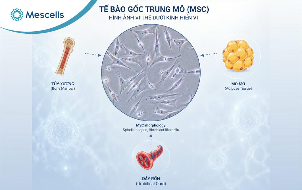 Điều trị xơ gan bằng tế bào gốc-03