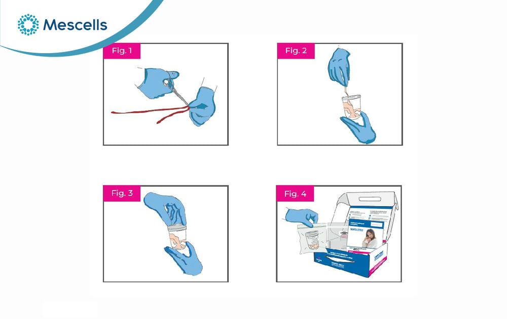 Lưu trữ tế bào gốc cho con-02