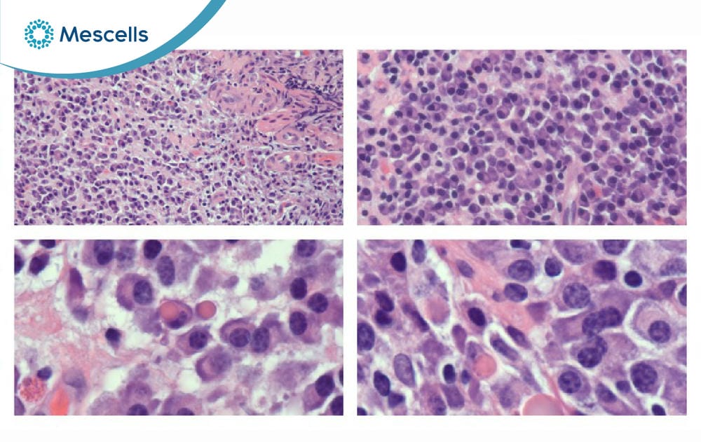 Tế bào Plasma là gì-02