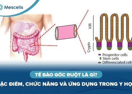Tế bào gốc ruột là gì-01
