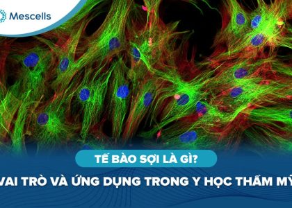 Tế bào sợi là gì-01