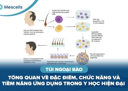 Túi ngoại bào-01