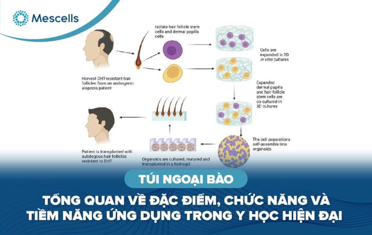 Túi ngoại bào-01