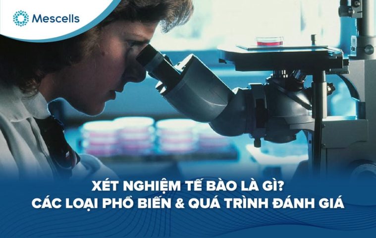 Xét nghiệm tế bào là gì-01
