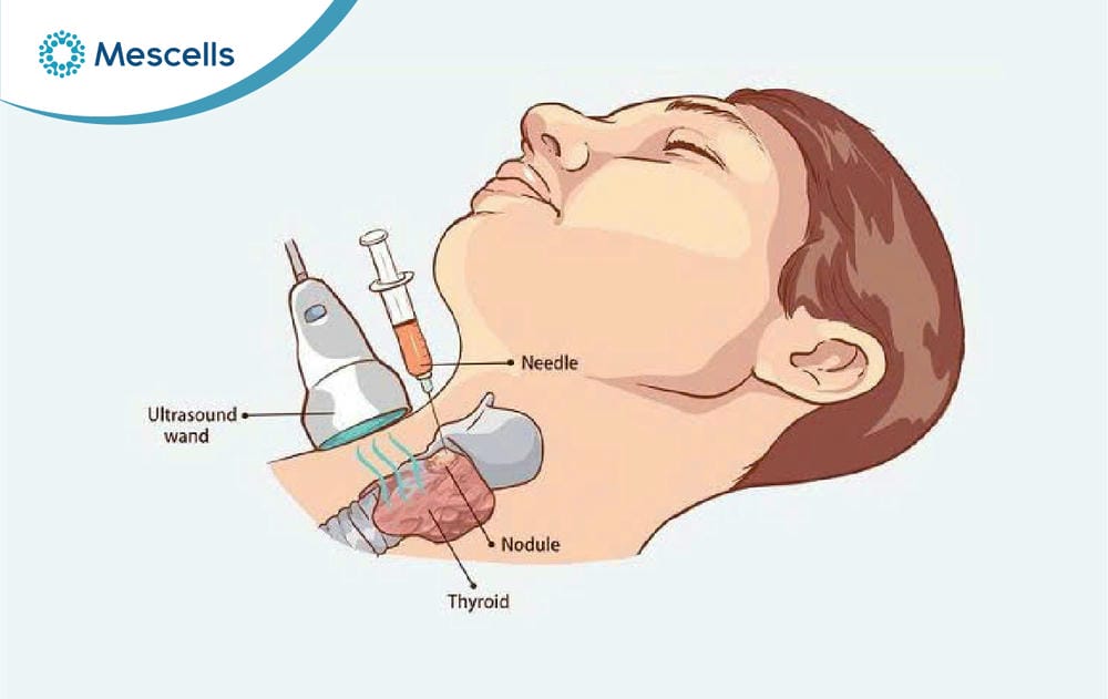 Xét nghiệm tế bào là gì-03