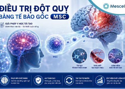 Tiềm năng của phương pháp tế bào gốc điều trị đột quỵ-01