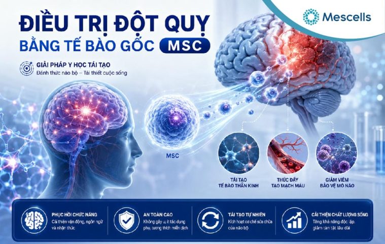 Tiềm năng của phương pháp tế bào gốc điều trị đột quỵ-01