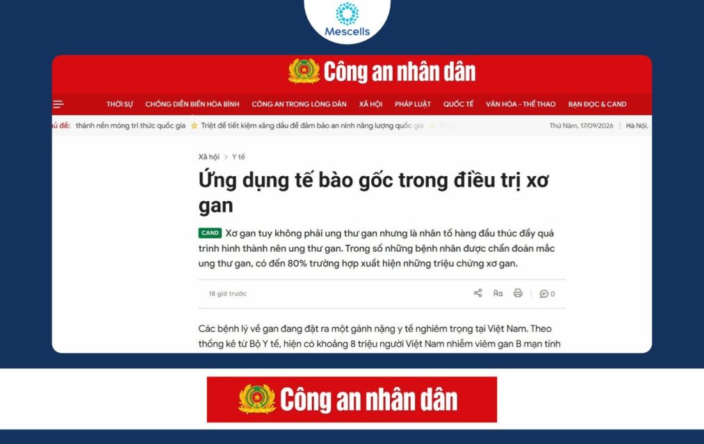 Ứng dụng tế bào gốc trong điều trị xơ gan