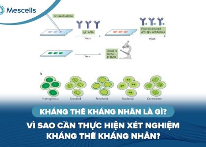 Kháng thể kháng nhân là gì-01