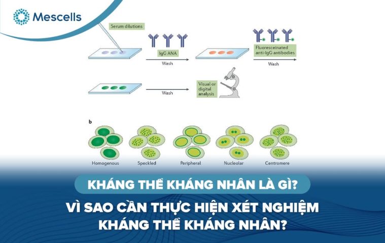 Kháng thể kháng nhân là gì-01