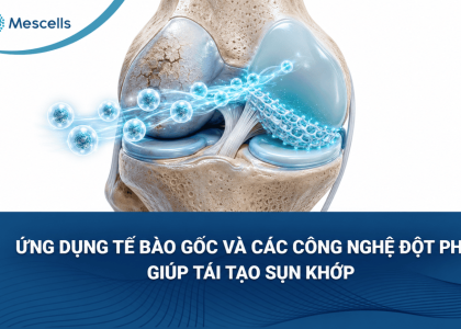 Tái tạo sụn khớp-01
