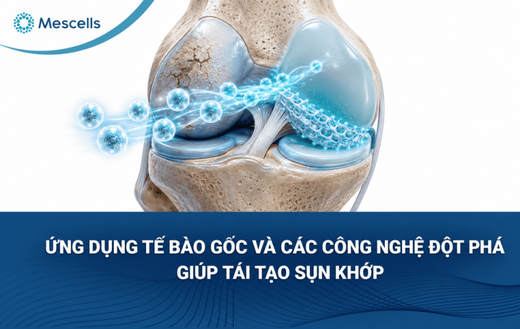 Tái tạo sụn khớp-01