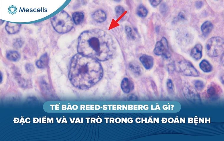 Tế bào Reed-Sternberg là gì-01