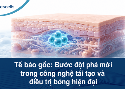 Tế bào gốc điều trị bỏng