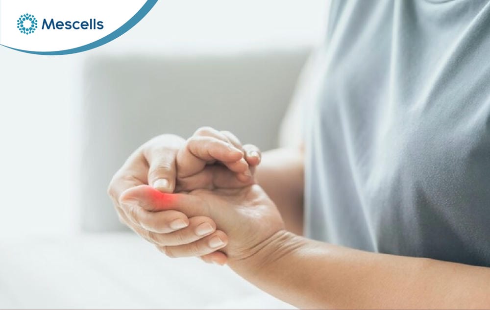 Viêm bao gân là gì Nguyên nhân, triệu chứng và cách điều trị-05