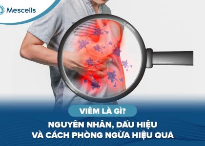 Viêm là gì-01