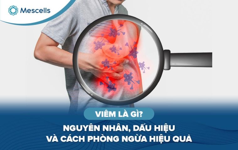 Viêm là gì-01