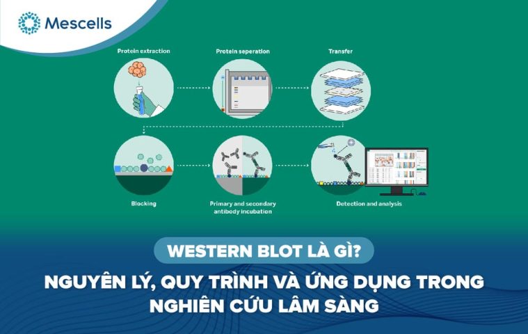 Western Blot là gì-01