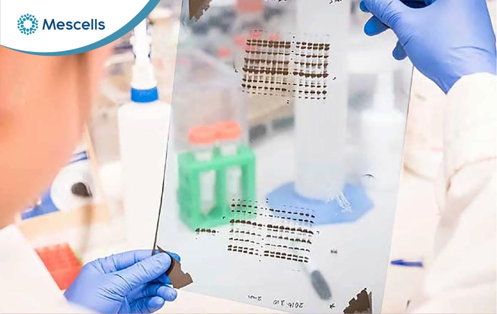 Western Blot là gì-06