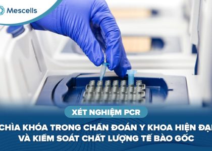 Xét nghiệm PCR Chìa khóa trong chẩn đoán y khoa hiện đại và kiểm soát chất lượng tế bào gốc-01