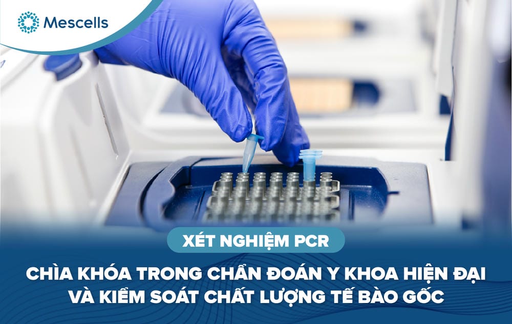 Xét nghiệm PCR Chìa khóa trong chẩn đoán y khoa hiện đại và kiểm soát chất lượng tế bào gốc-01
